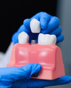 降价后的种植牙服务将于3月下旬到4月中旬落地实施